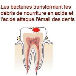 formation des caries